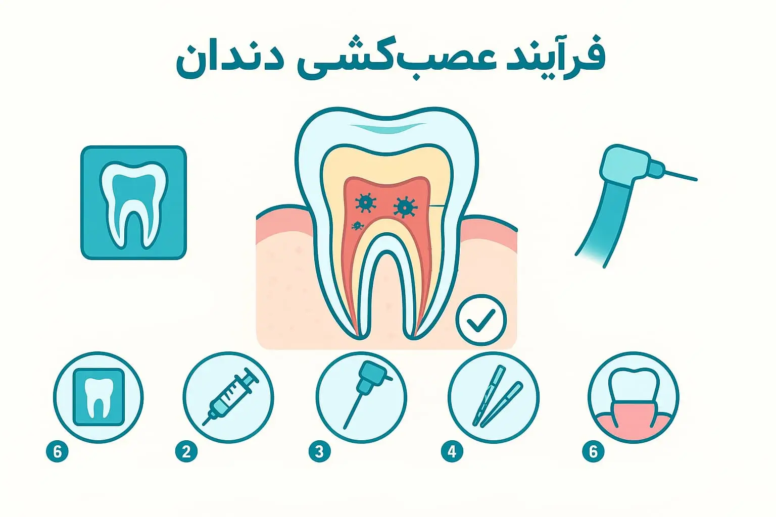 عصب کشی دندان چگونه انجام می شود؟