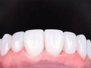 کامپوزیت دندان در غرب تهران کلینیک دردیس