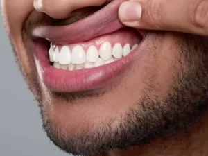 عوامل موثر بر هزینه جرمگیری دندان