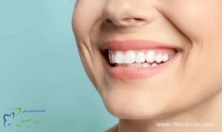 هزینه جرمگیری دندان با بیمه