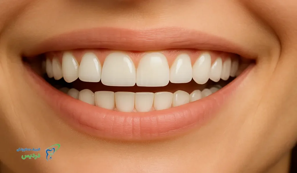 رنگ دندان b1