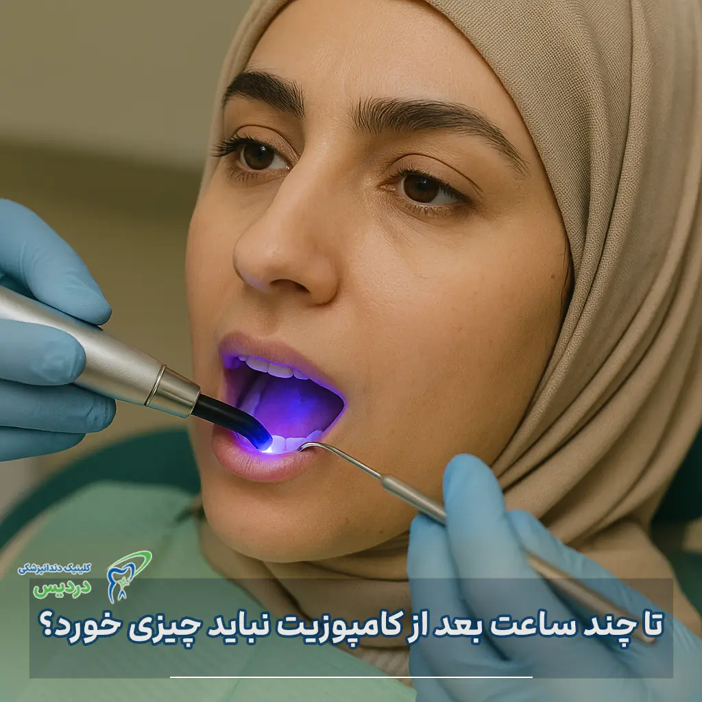 بعد از کامپوزیت چی بخوریم