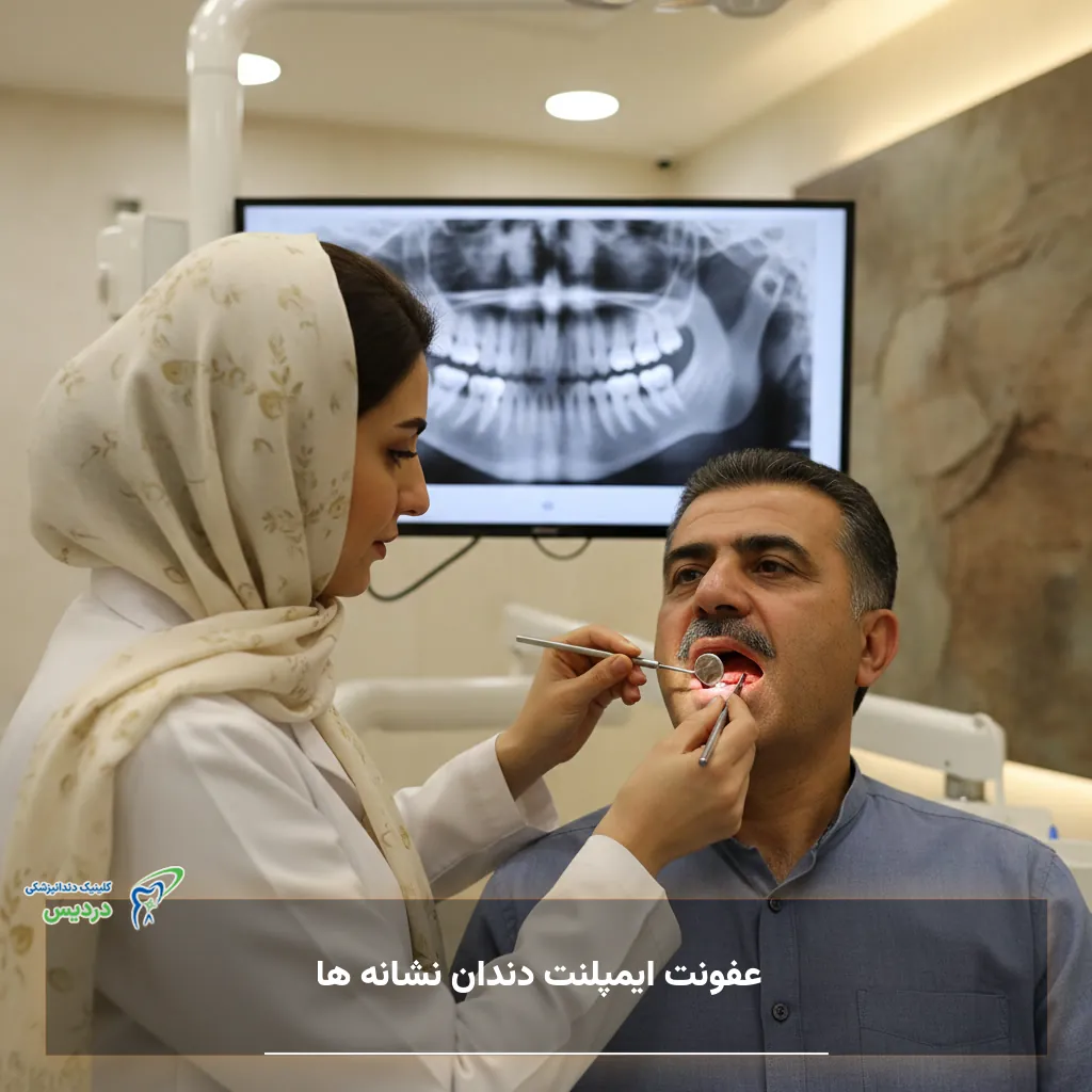 نشانه های عفونت ایمپلنت دندان مانند تورم، قرمزی و ترشح