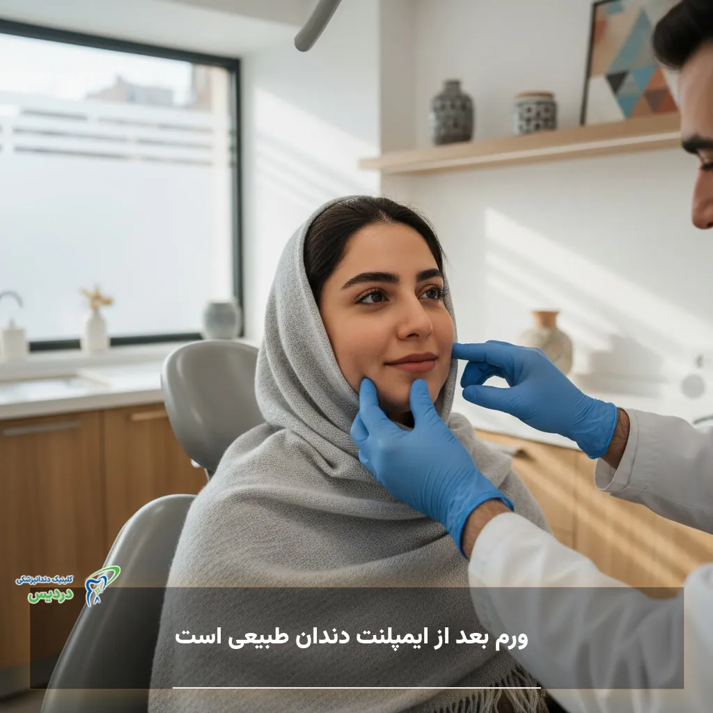 ورم بعد از ایمپلنت دندان و زمان طبیعی کاهش آن