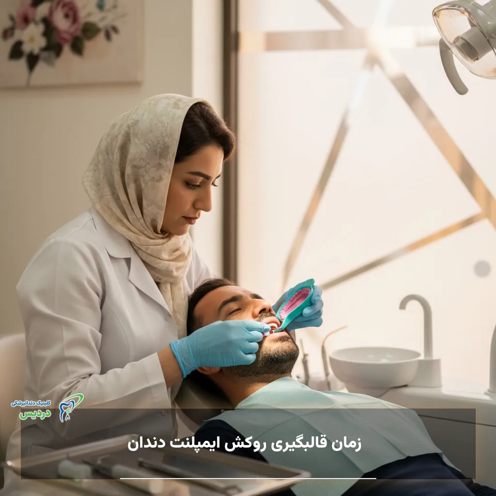 زمان قالبگیری روکش ایمپلنت دندان و مراحل آماده سازی روکش