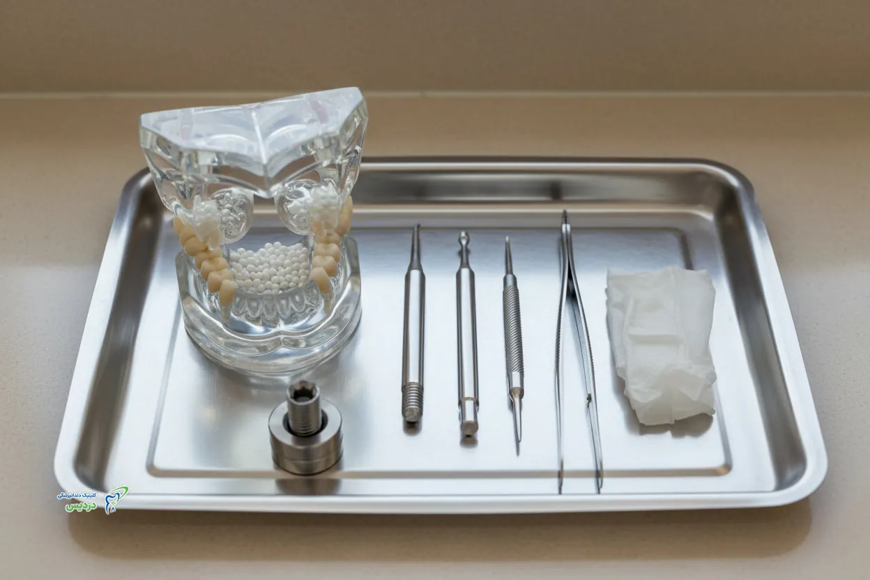 مراقبت های بعد از لیفت سینوس برای ایمپلنت دندان