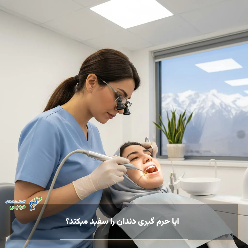 ایا جرم گیری دندان را سفید میکند و چه تفاوتی با بلیچینگ دارد؟