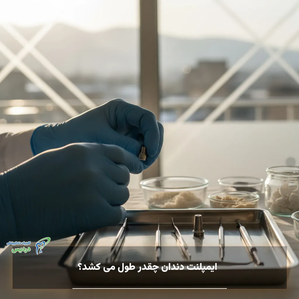 مدت زمان ایمپلنت دندان از جراحی تا نصب روکش