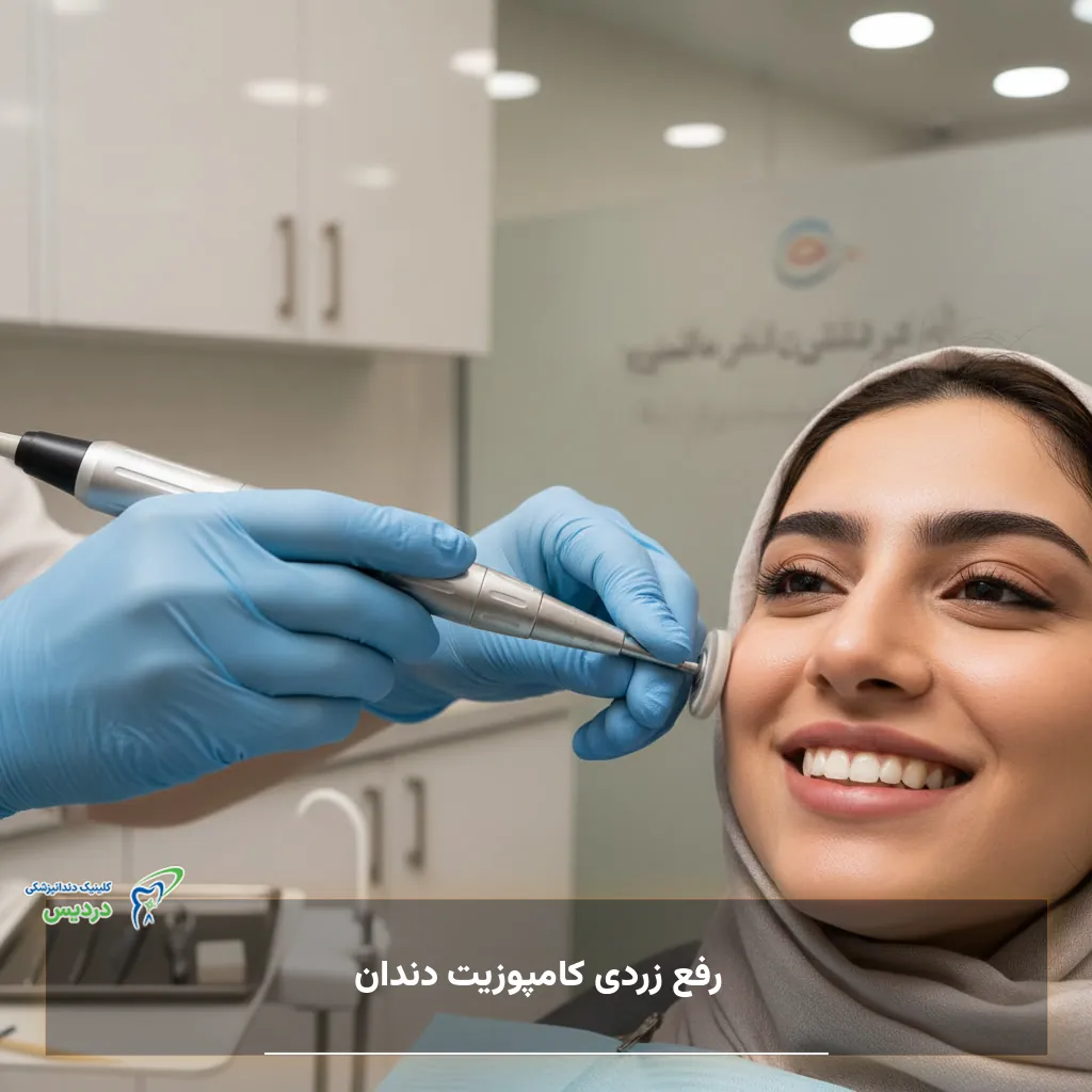 رفع زردی و لکه های کامپوزیت دندان با روش های تخصصی
