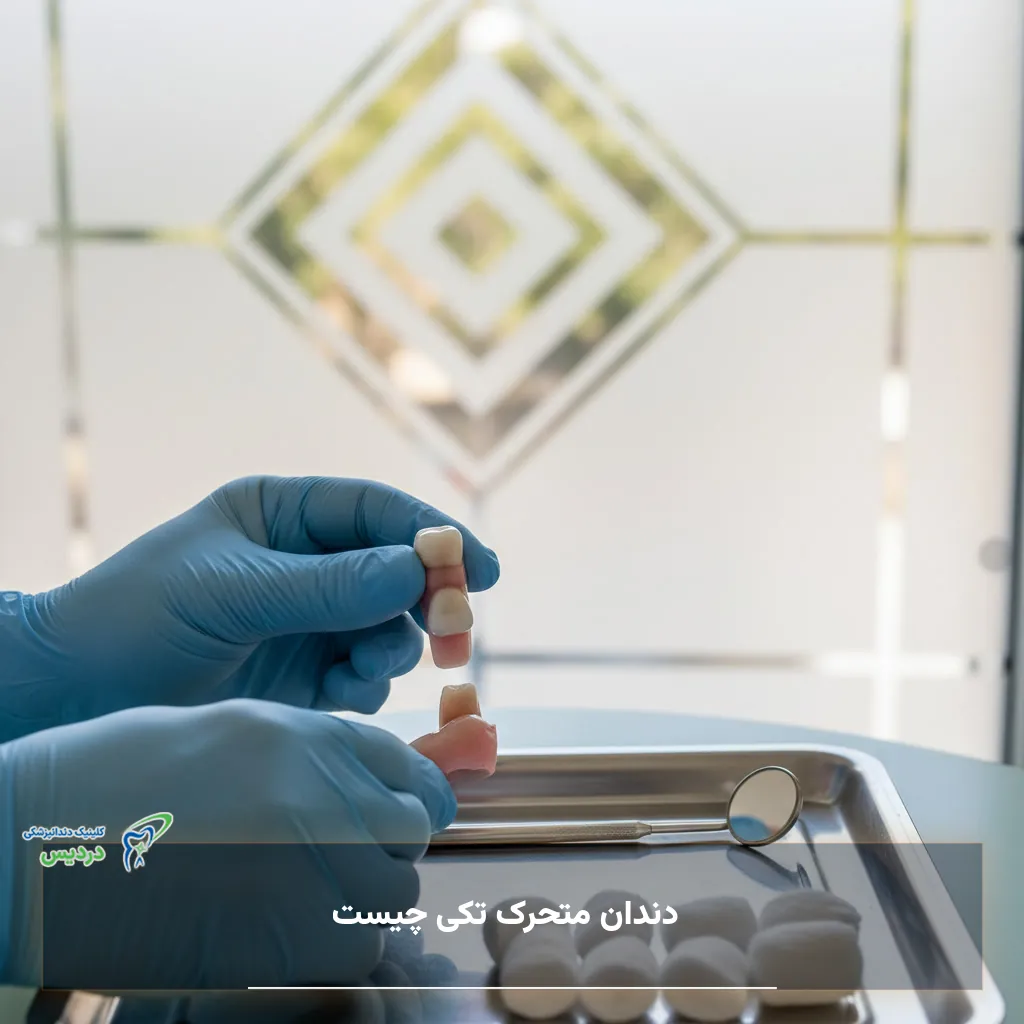 دندان متحرک تکی چیست و چه کاربردی دارد