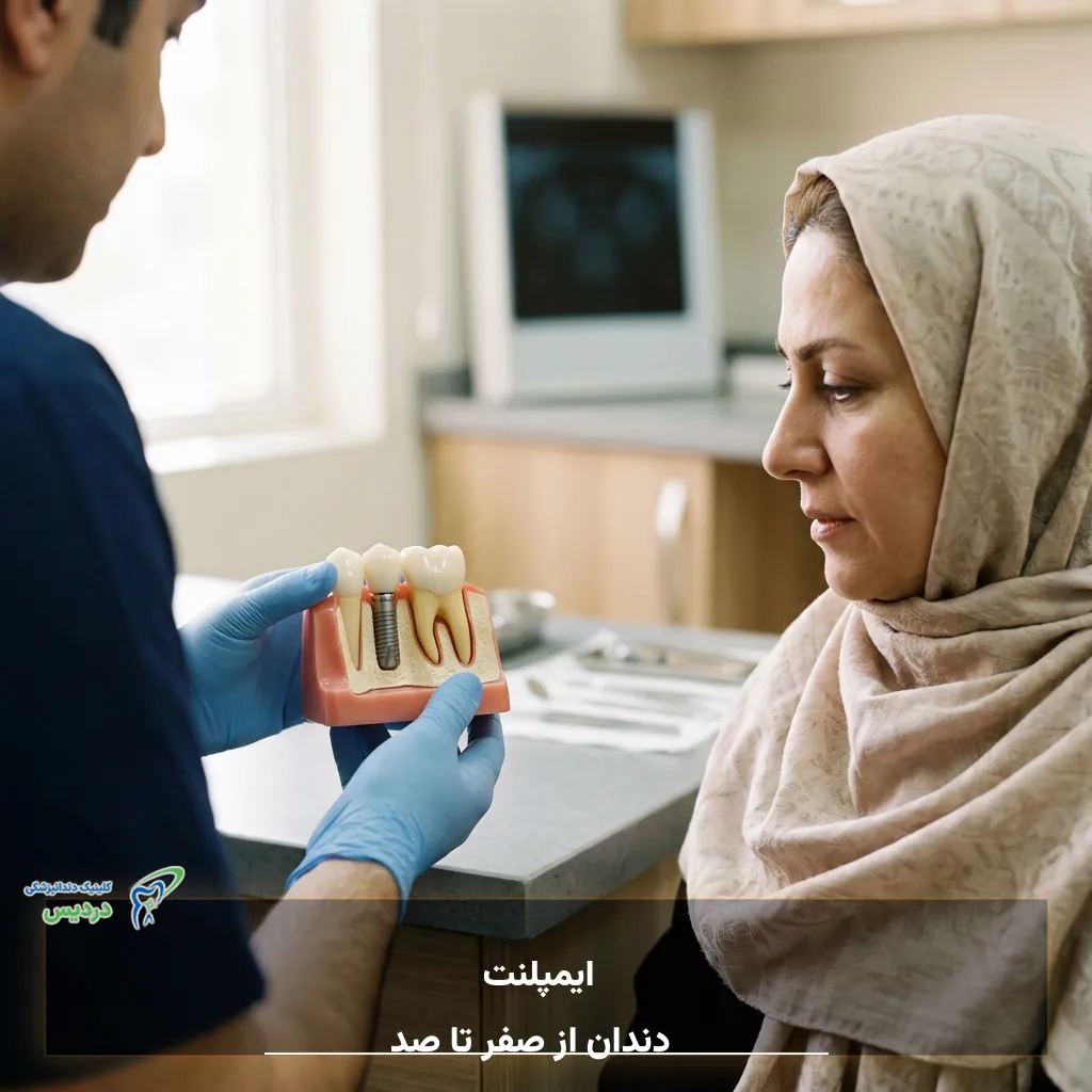 اجزای اصلی ایمپلنت دندان شامل فیکسچر اباتمنت و روکش