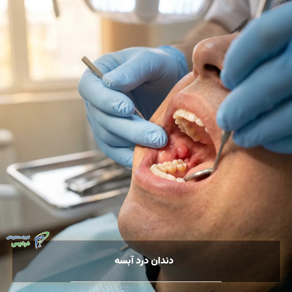 درد و عفونت آبسه دندان