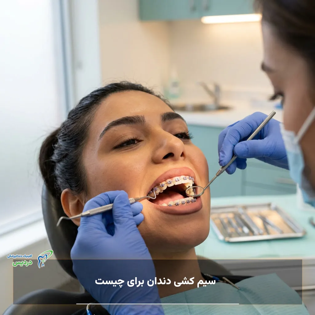 کاربرد سیم کشی دندان برای مرتب کردن دندان‌ها