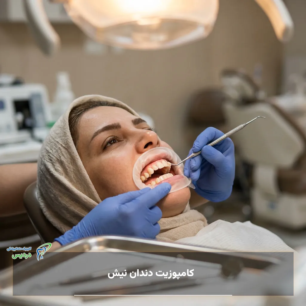 کامپوزیت و اصلاح فرم دندان نیش