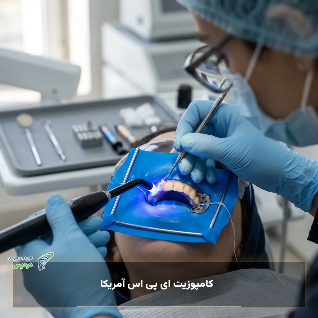 کامپوزیت ای پی اس برای ترمیم و زیبایی دندان