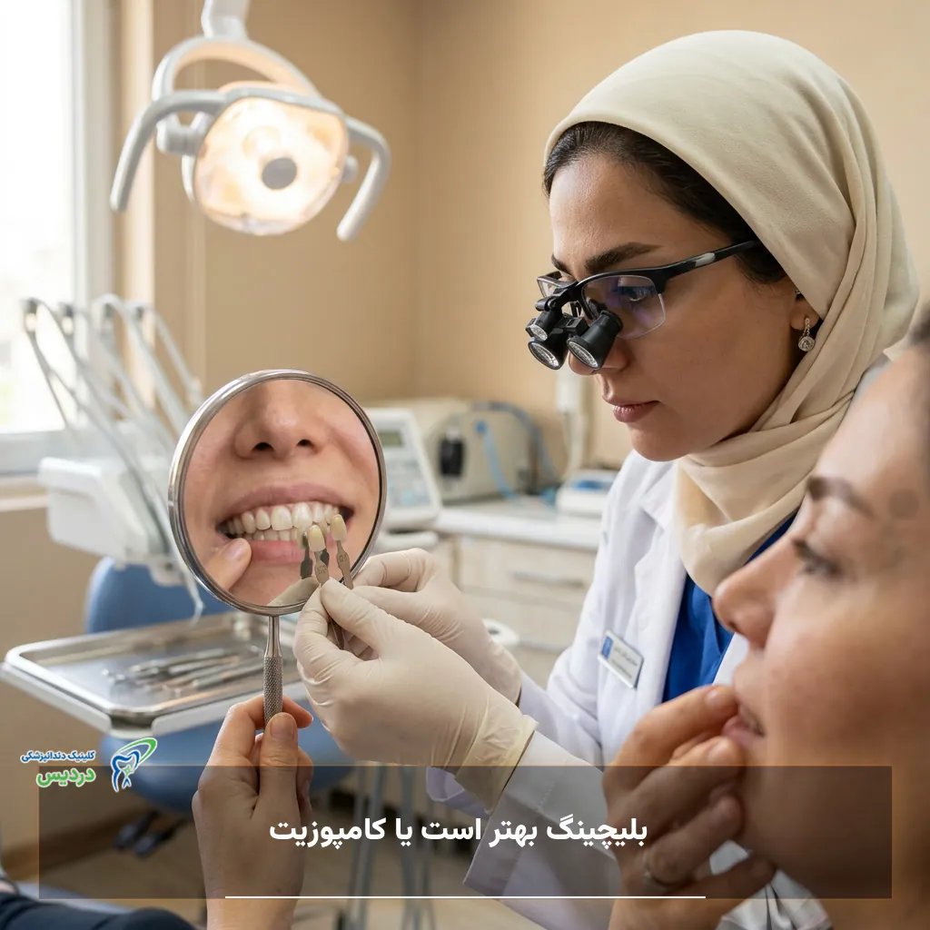 بلیچینگ دندان برای روشن‌تر شدن رنگ دندان‌های طبیعی