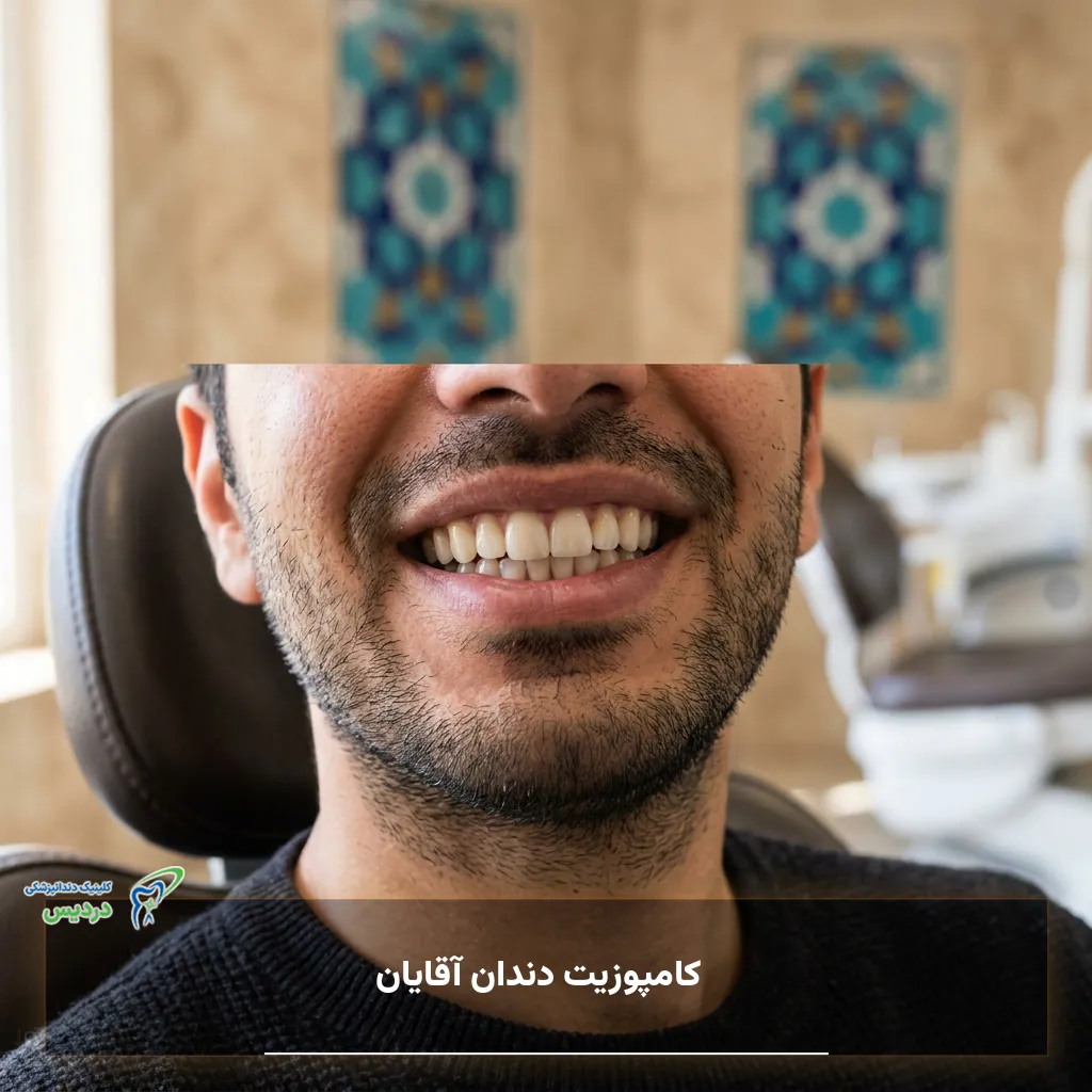 کامپوزیت دندان آقایان با ظاهر طبیعی