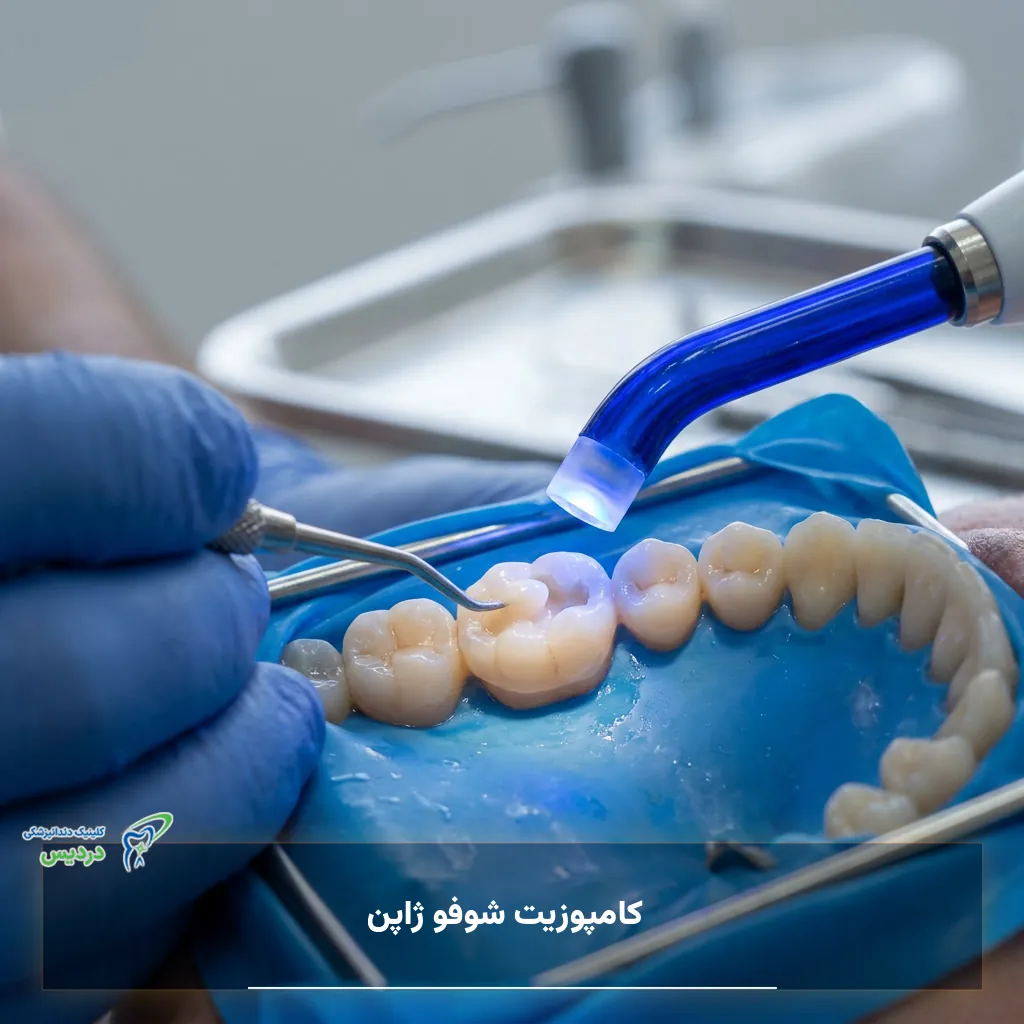 ویژگی‌های کامپوزیت شوفو ژاپن