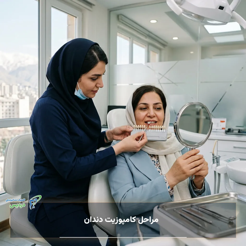 بررسی مناسب بودن کامپوزیت دندان